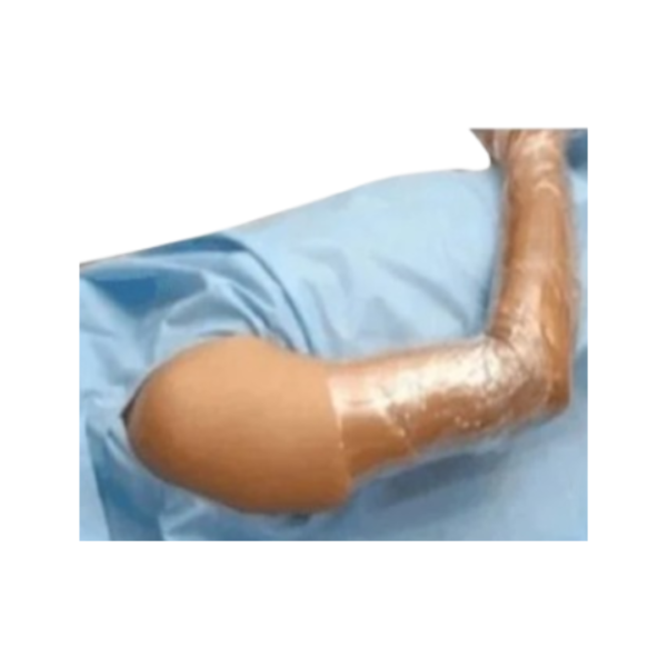 Arm U Shoulder Rizochem Pharmaceuticals